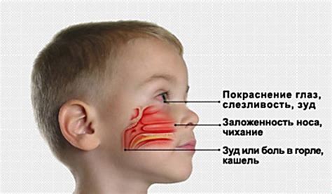 Причины ребенка хрюкать носом без соплей