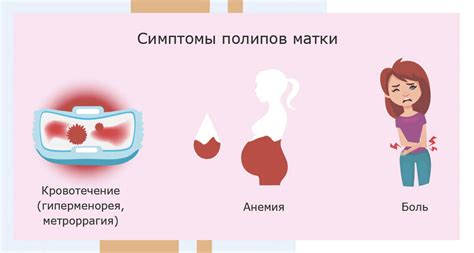 Причины самовыпадения полипа в матке