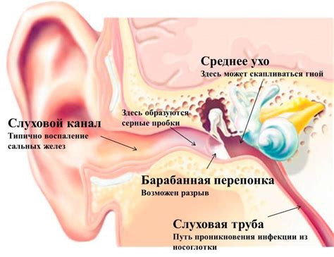 Причины течения уха