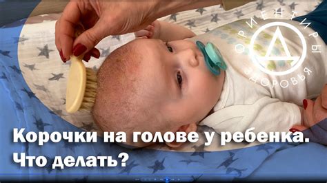 Причины частого потоотделения на голове у детей