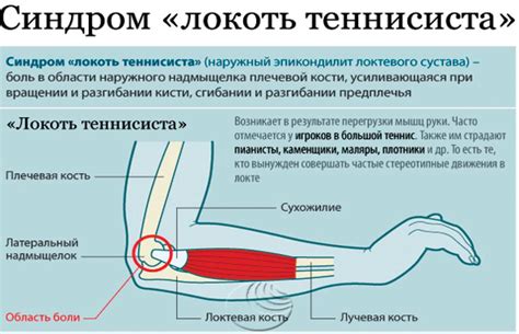 Причины чесания левого локтя