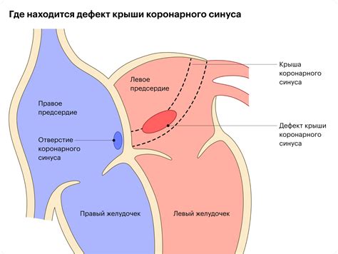 При сокращении сосудов кровь может быть недостаточно оксигенирована