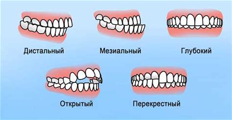 Проблемы, связанные с неправильным размером жиклера