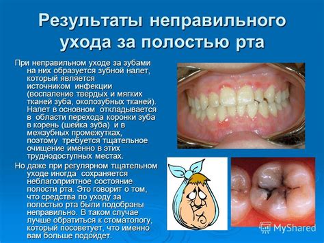 Проблемы со зубами и ротовой полостью