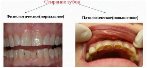 Проблемы стирания темных тканей вместе