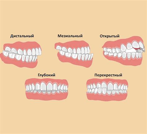 Проблемы с аппаратом