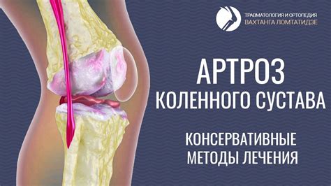 Проблемы с коленом