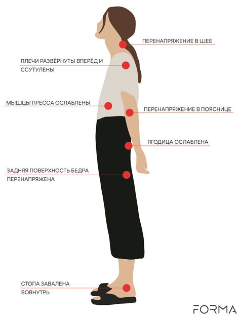 Проблемы с обувью и осанкой