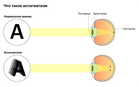 Проблемы с фокусировкой и астигматизм