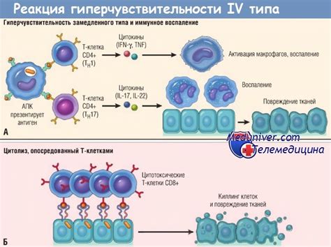 Проверка аллергической реакции перед применением