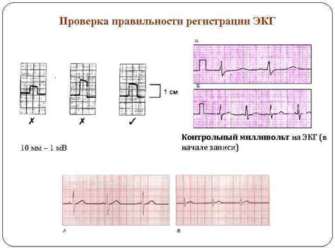 Проверка доступности ЭКГ