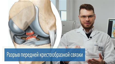 Прогноз срастания порванных связок коленного сустава