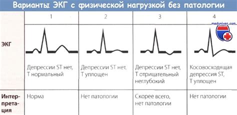 Пролистайте до раздела "ЭКГ"