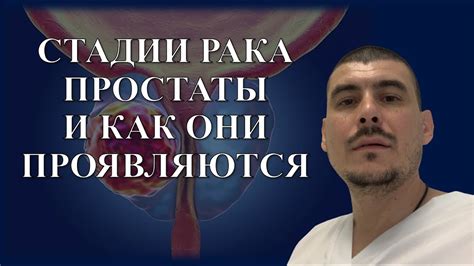 Пролонгация жизни без простаты