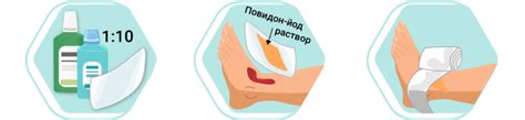 Промыть рану водой или антисептиком?