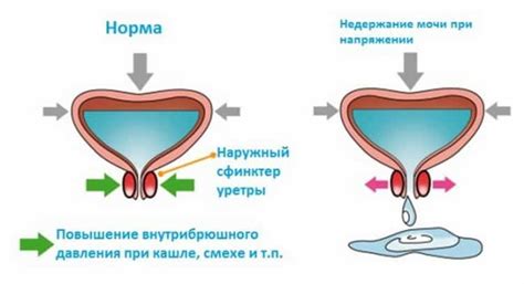 Профилактика жирной мочи у женщин