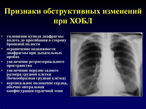 Профилактика заболеваний бронхов и предотвращение образования мокроты