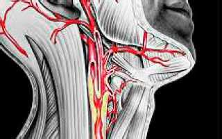 Профилактика и лечение заболеваний шейных сосудов