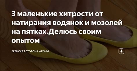 Профилактика мозолей на пятках: советы экспертов