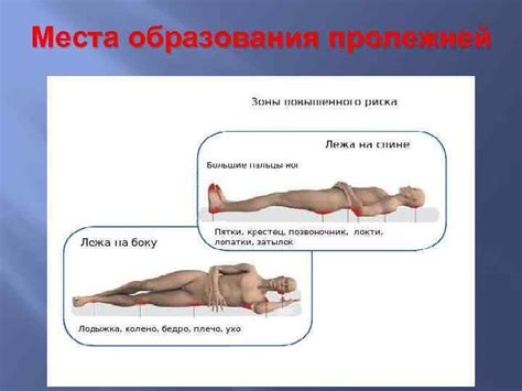 Профилактика опрелостей и применение защитной пудры