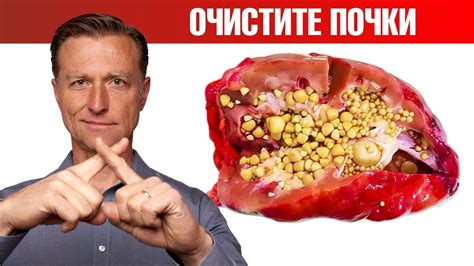 Профилактика породинок на почках