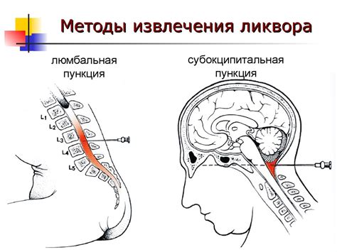 Профилактика протечки ликвора