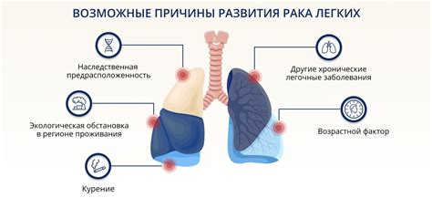 Профилактика развития опухания лица при раке легких