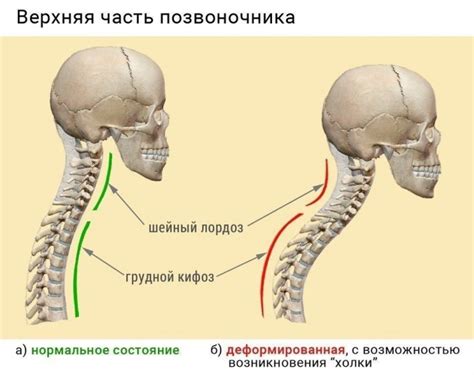 Профилактика холки на шее