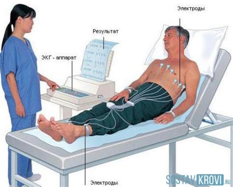 Процедура проведения ЭКГ