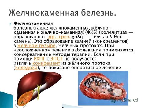 Процедуры диагностики камней в слизисто-железистых протоках пищеварительной системы