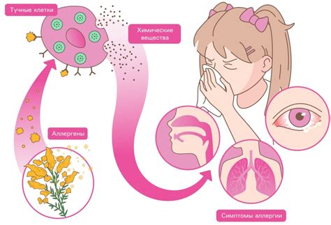Процесс развития аллергической реакции
