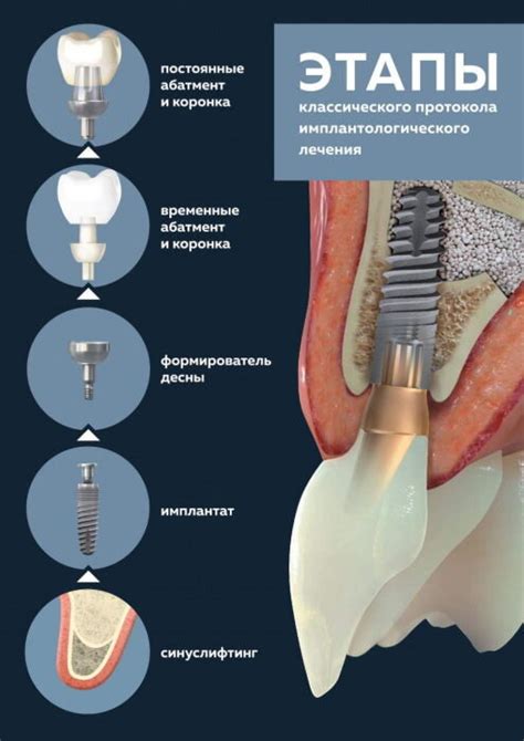 Процесс установки аятана