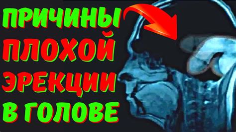 Психологические аспекты проблемы эрекции