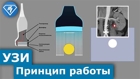 Раздел 2: Принципы работы аппарата влок