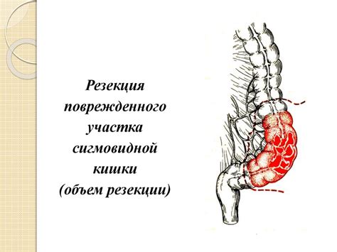 Раздел 3: Повреждение органов