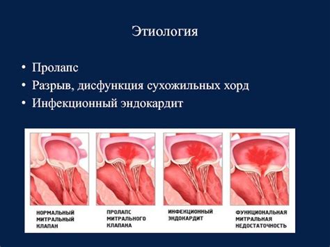 Раздел 5: Особые случаи и редкие виды хорд