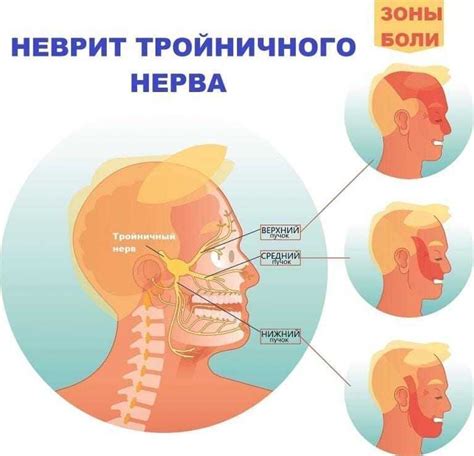 Раздражение тройничного нерва: причины и симптомы