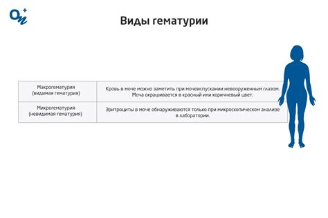 Различные виды гематурии