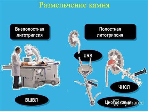 Размельчение камня