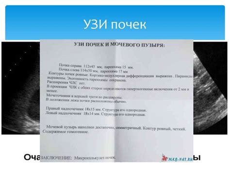 Размеры мочевого пузыря у ребенка: факторы, которые могут вызывать интерес и раздражение