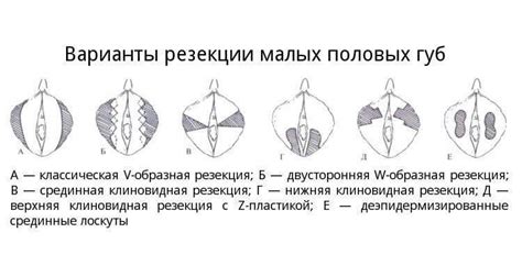 Размер и форма половых губ