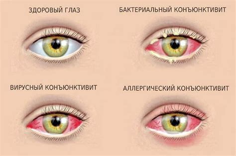 Разновидности операций на глазах у детей: какие методы используются