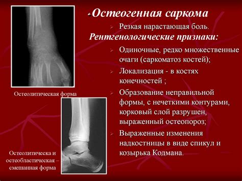 Разрушение костей и суставов как факторы хромоты