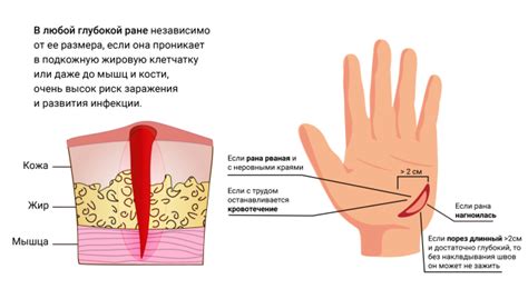 Раны и порезы: как образуются иссушенные участки кожи