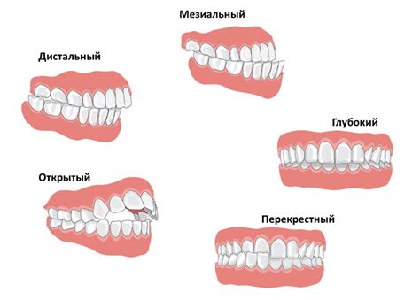 Расположение пояса: где он должен быть и как это влияет на талию