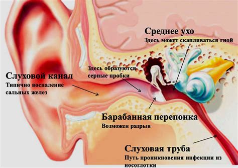 Расположите уши Микулы с одной и другой стороны головы