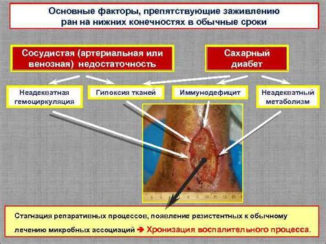 Распространенные ошибки, препятствующие заживлению шва