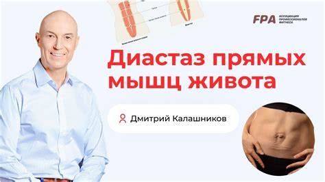 Рацион питания для сокращения диастаза прямых мышц живота