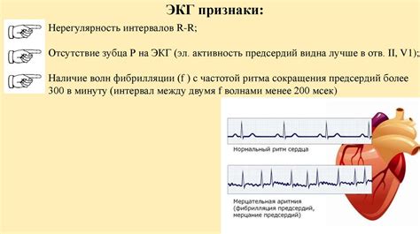 Рекомендации для пациентов с мерцательной аритмией и тяжелым дыханием