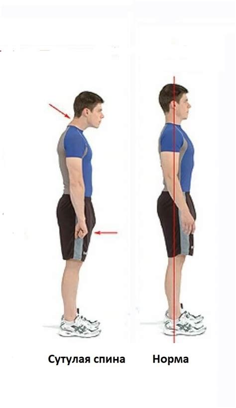 Рекомендации по улучшению осанки